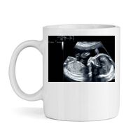 SAME DAY Mug Thumbnail
